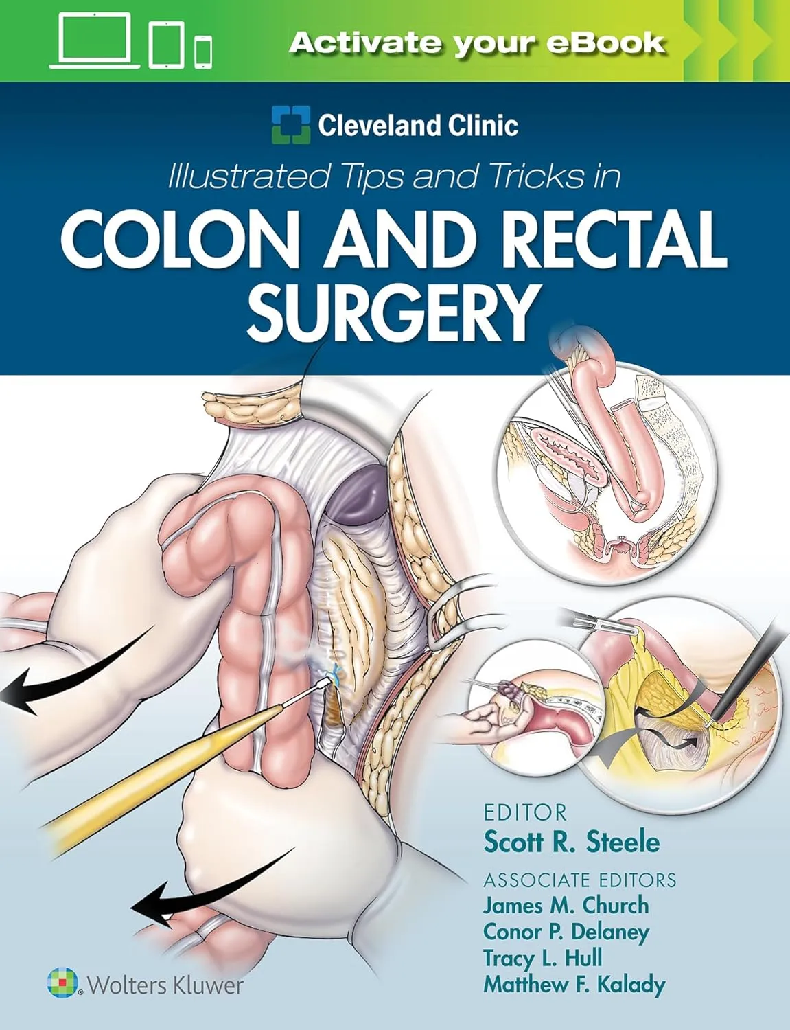 Cleveland Clinic Illustrated Tips And Tricks In Colon And Rectal Surgery | Paperback