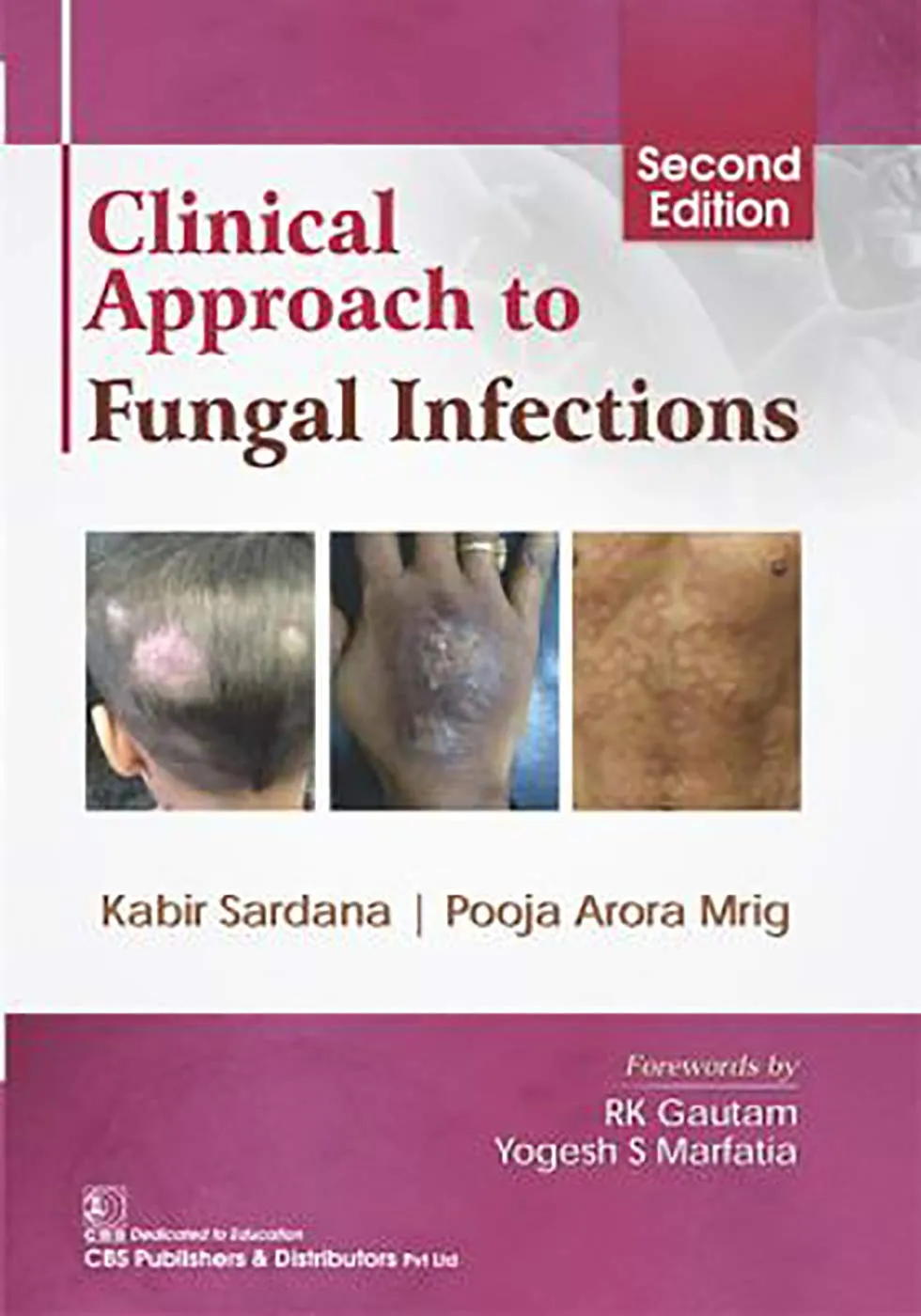 Clinical Approach to Fungal Infections | 2nd Edition | Hardcover