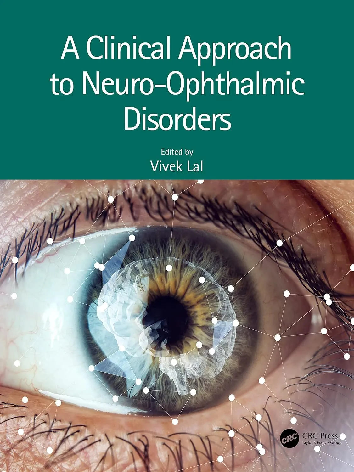 A Clinical Approach To Neuro Ophthalmic Disorders | Paperback