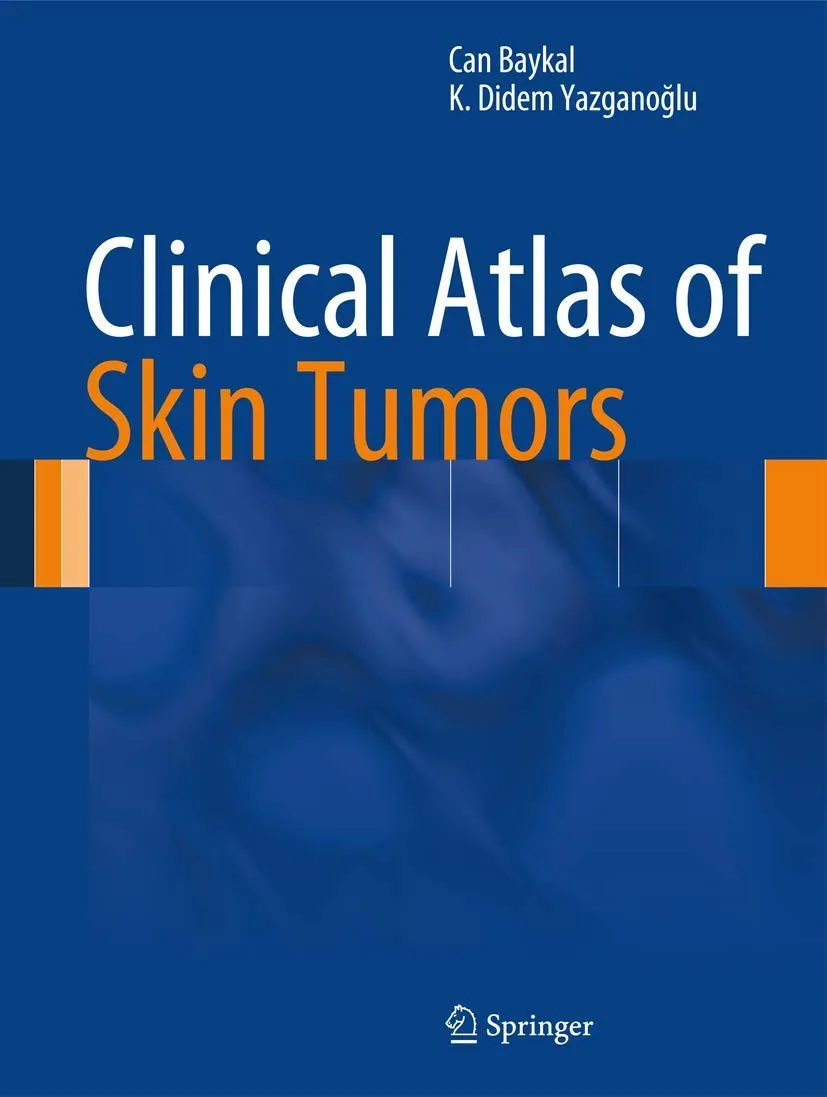 Clinical Atlzs of Skin Tumors | Hardcover