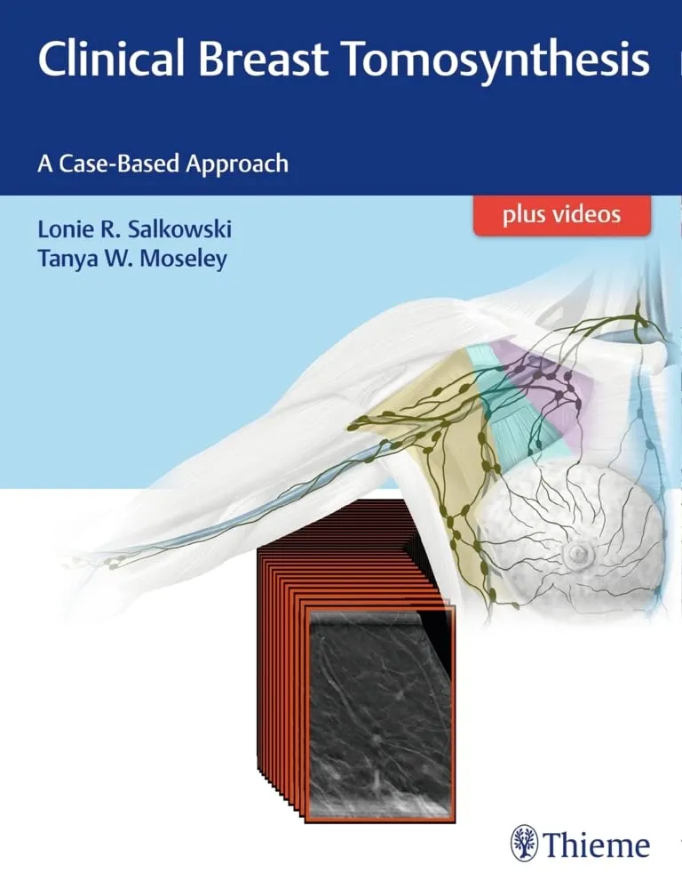 Clinical Breast Tomosynthesis | Hardcover