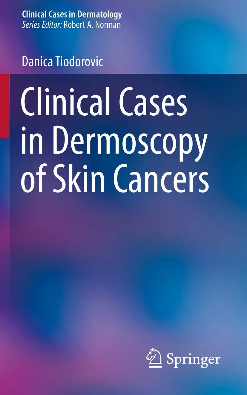 Clinical Cases in Dermoscopy of Skin Cancers | Paperback
