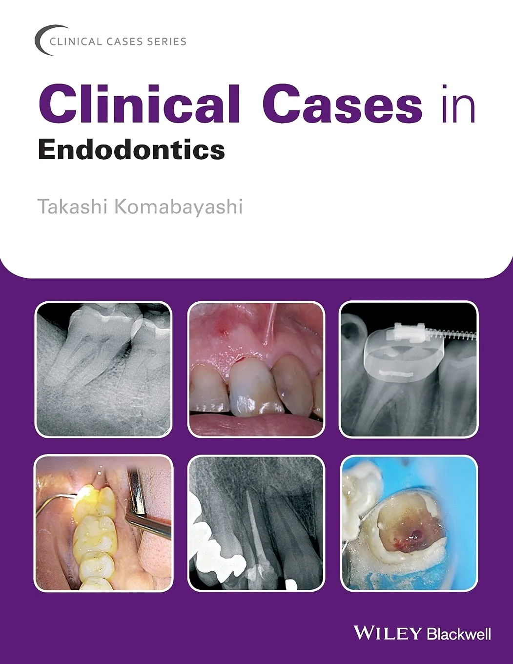Clinical Cases in Endodontics | Paperback