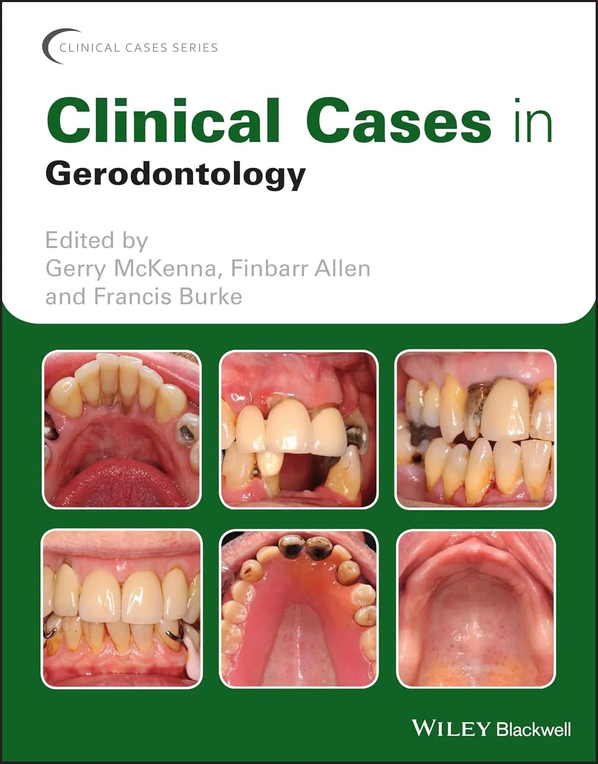 Clinical Cases In Gerodontology | Paperback