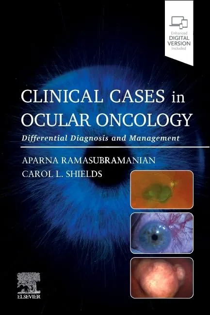 Clinical Cases In Ocular Oncology Differential Diagnosis And Management With Access Code | Paperback