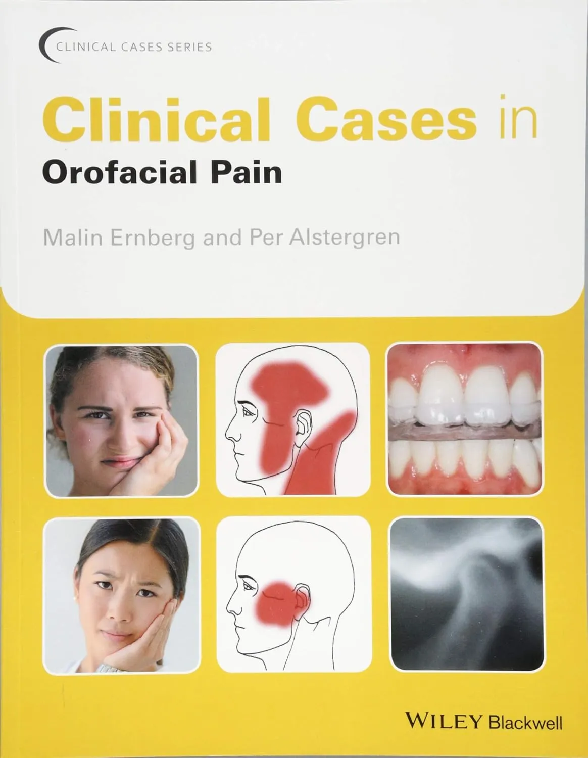 Clinical Cases in Orofacial Pain | Paperback