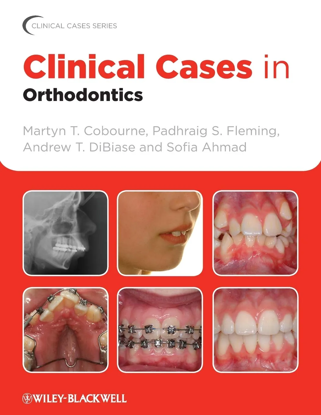 Clinical Cases in Orthodontics | Paperback