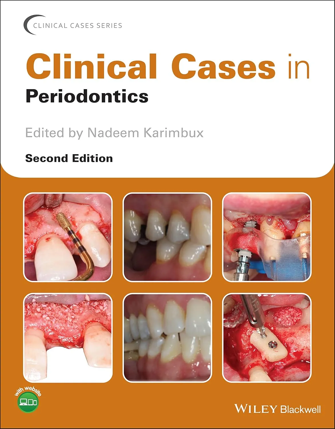 Clinical Cases In Periodontics 2nd Edition | Paperback