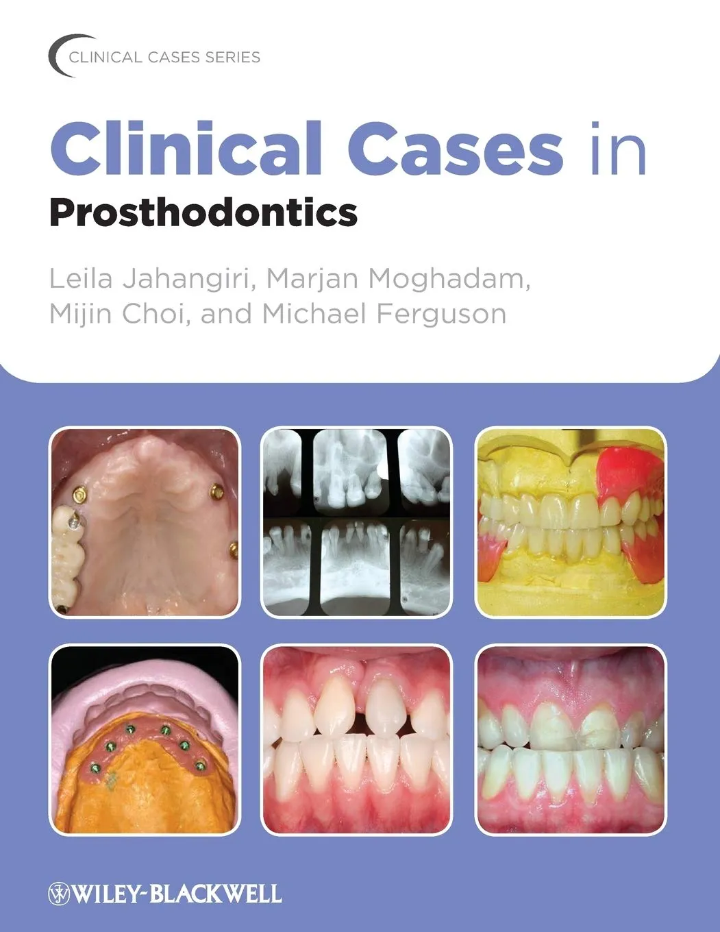 Clinical Cases in Prosthodontics | Paperback