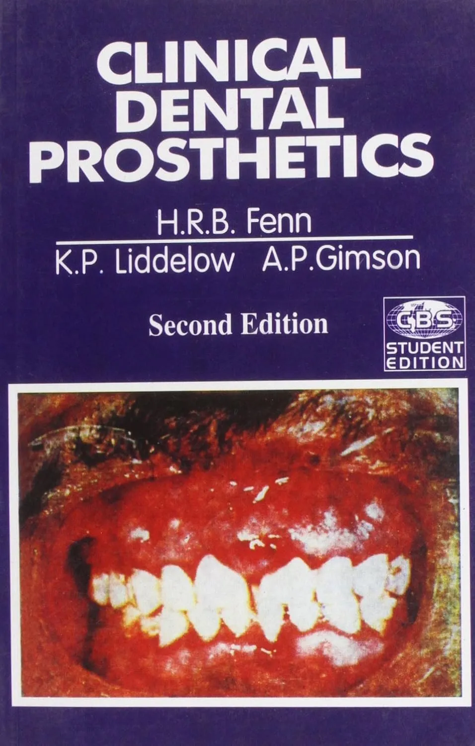 Clinical Dental Prosthetics | 2nd Edition (CBS Student Edition)