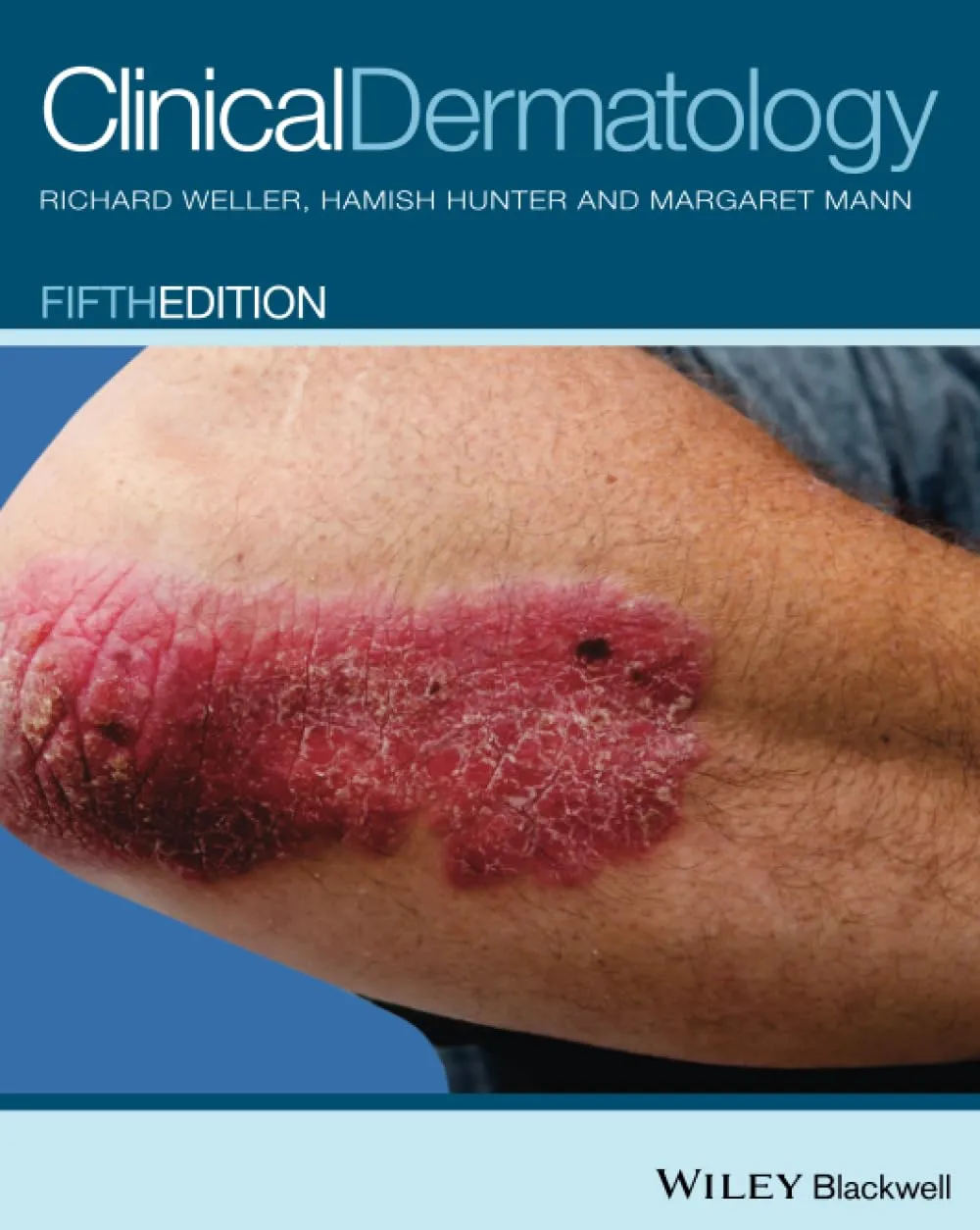 Clinical Dermatology | 5th Edition | Paperback