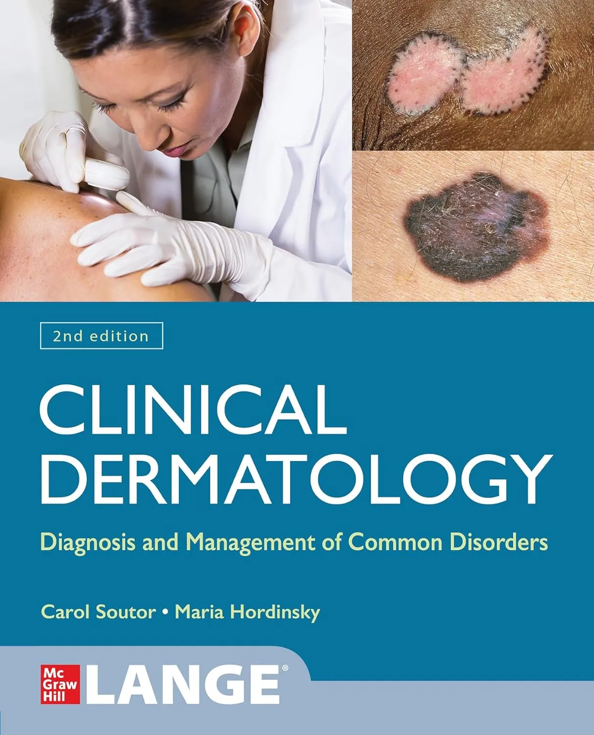 Clinical Dermatology Diagnosis And Management Of Common Disorders 2nd Edition | Paperback
