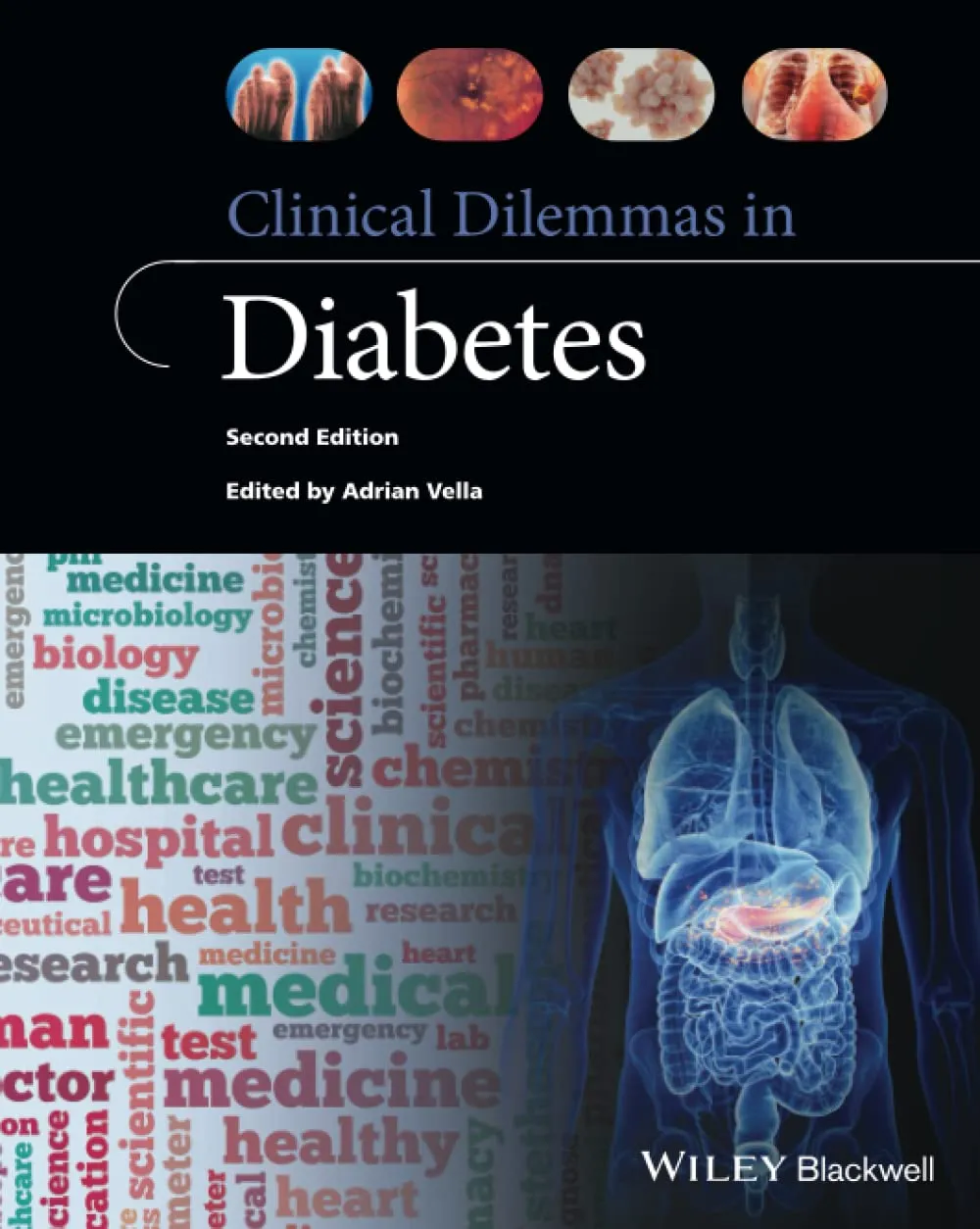 Clinical Dilemmas In Diabetes 2nd Edition | Paperback
