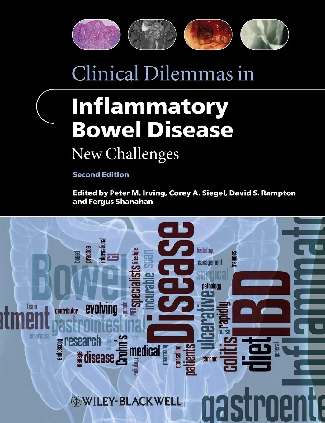 Clinical Dilemmas in Inflammatory Bowel Disease New Challenges | 2nd Edition | Paperback