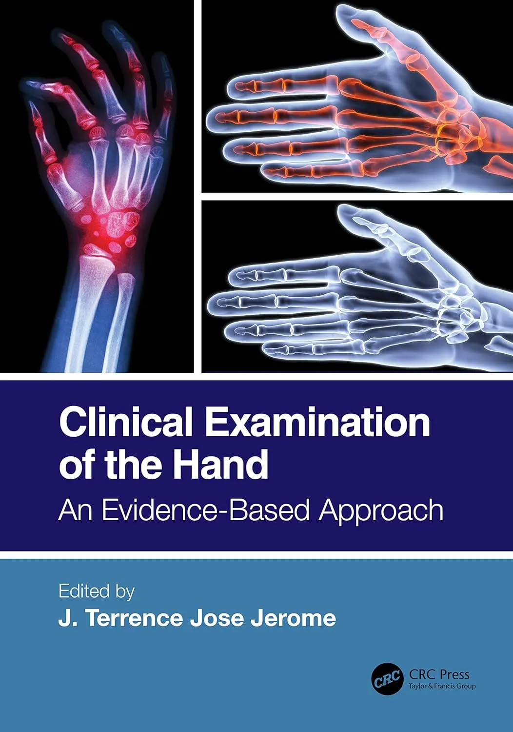 Clinical Examination Of The Hand An Evidence Based Approach | Paperback