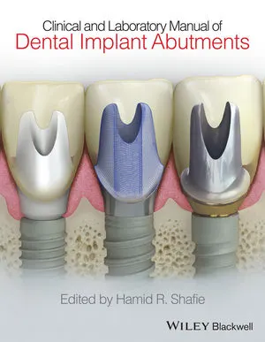 Clinical and Laboratory Manual of Dental Implant Abutments | 1st Edition | Hardcover