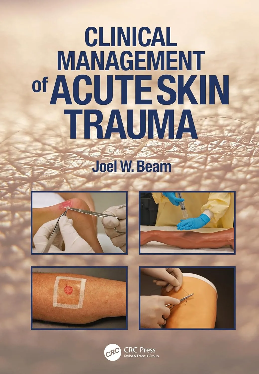 Clinical Management Of Acute Skin Trauma | Paperback