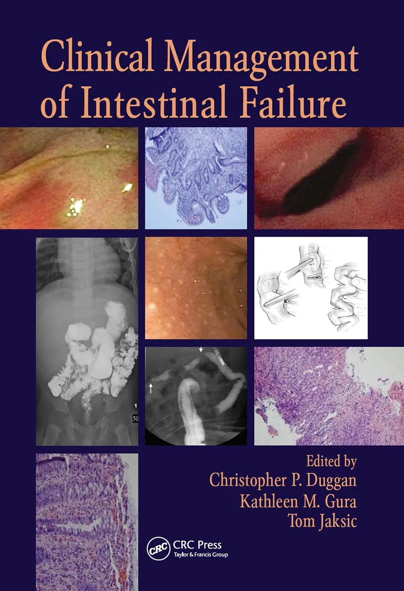 Clinical Management of Intestinal Failure | With CD | Hardcover