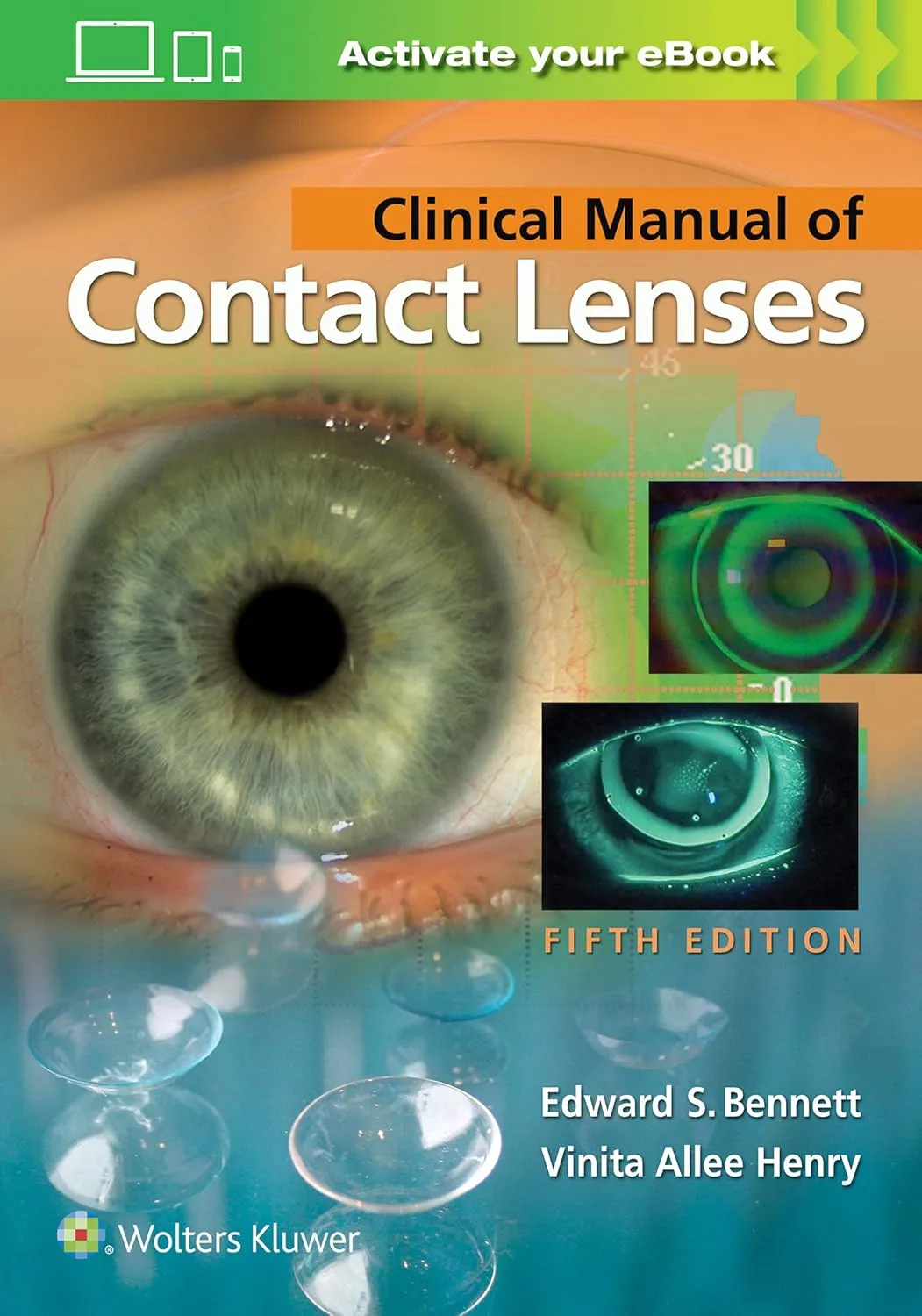 Clinical Manual of Contact Lenses | 5th Edition | Paperback