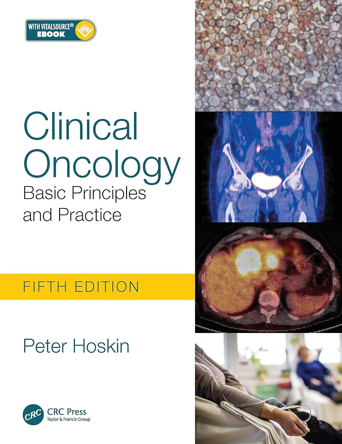 Clinical Oncology Basic Principles and Practice With Access Code | 5th Edition | Paperback