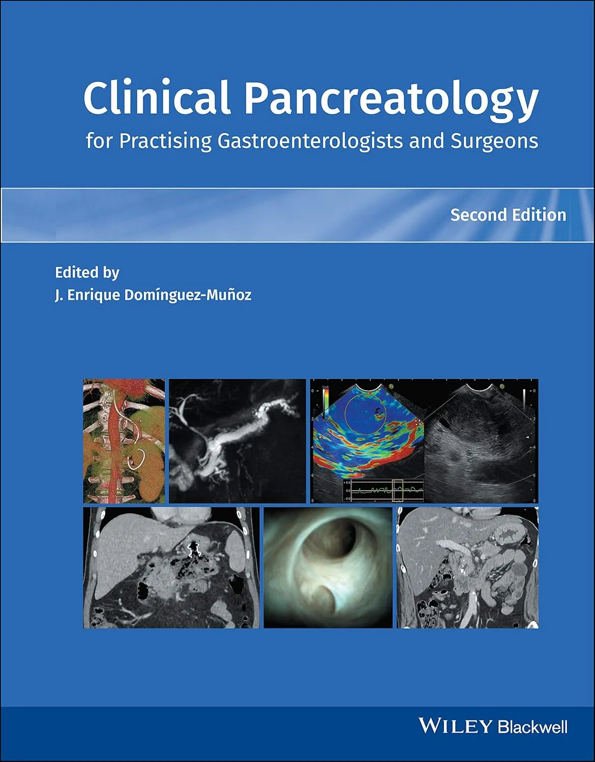Clinical Pancreatology For Practising Gastroenterologists And Surgeons 2nd Edition | Hardcover