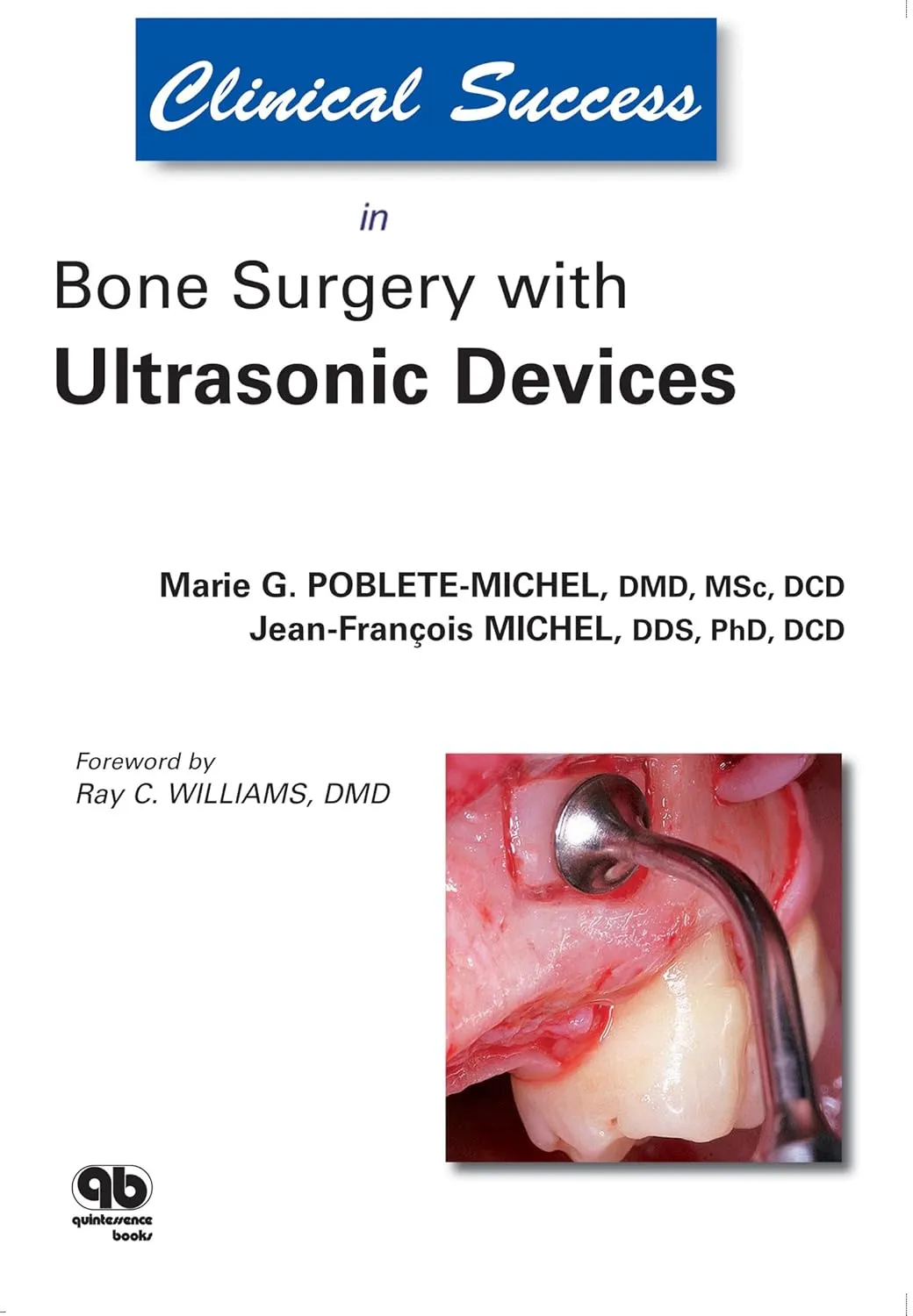 Clinical Success in Bone Surgery with Ultrasonic Devices | Paperback