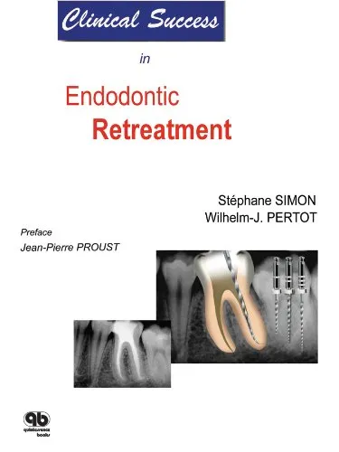 Clinical Success in Endodontic Retreatment | Paperback