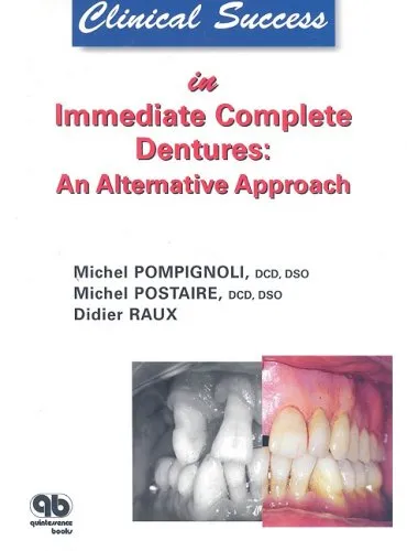 Clinical Success in Immdiate Complete Denture An Alternative Approach | Hardcover