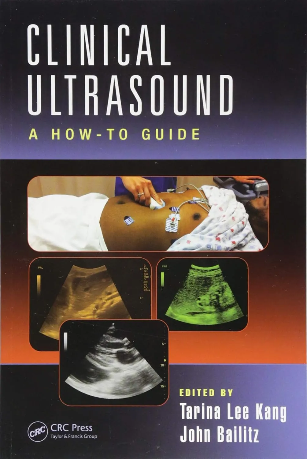 Clinical Ultrasound A How-To Guide | Paperback