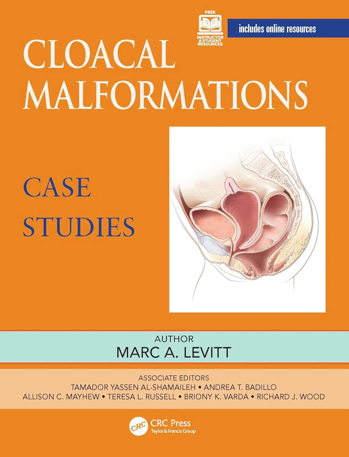 Cloacal Malformations Case Studies | Paperback