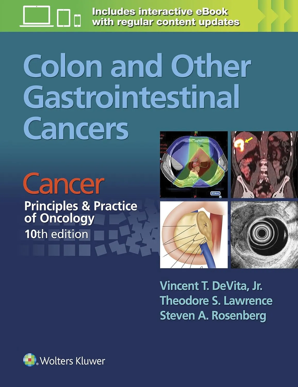 Colon and Other Gastrointestinal Cancers | 10th Edition | Paperback