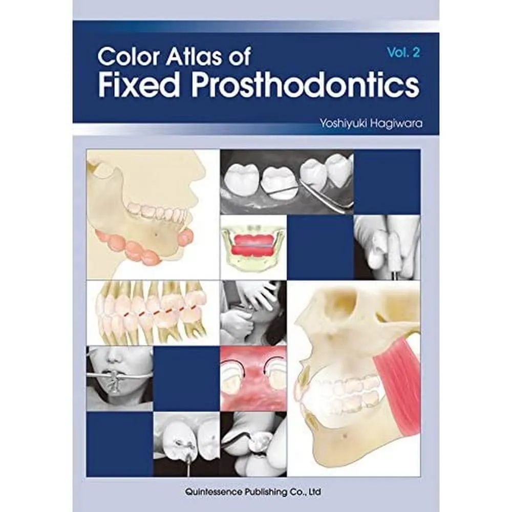 Color Atlas of Fixed Prosthodontics | Volume 2 | Paperback
