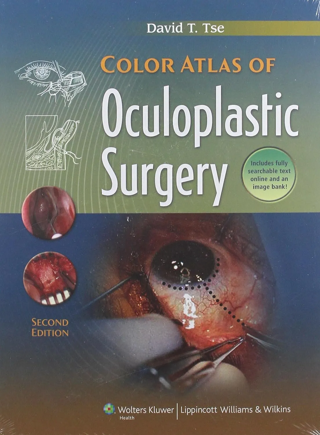 Color Atlas Of Oculoplastic Surgery | 2nd Edition | Hardcover
