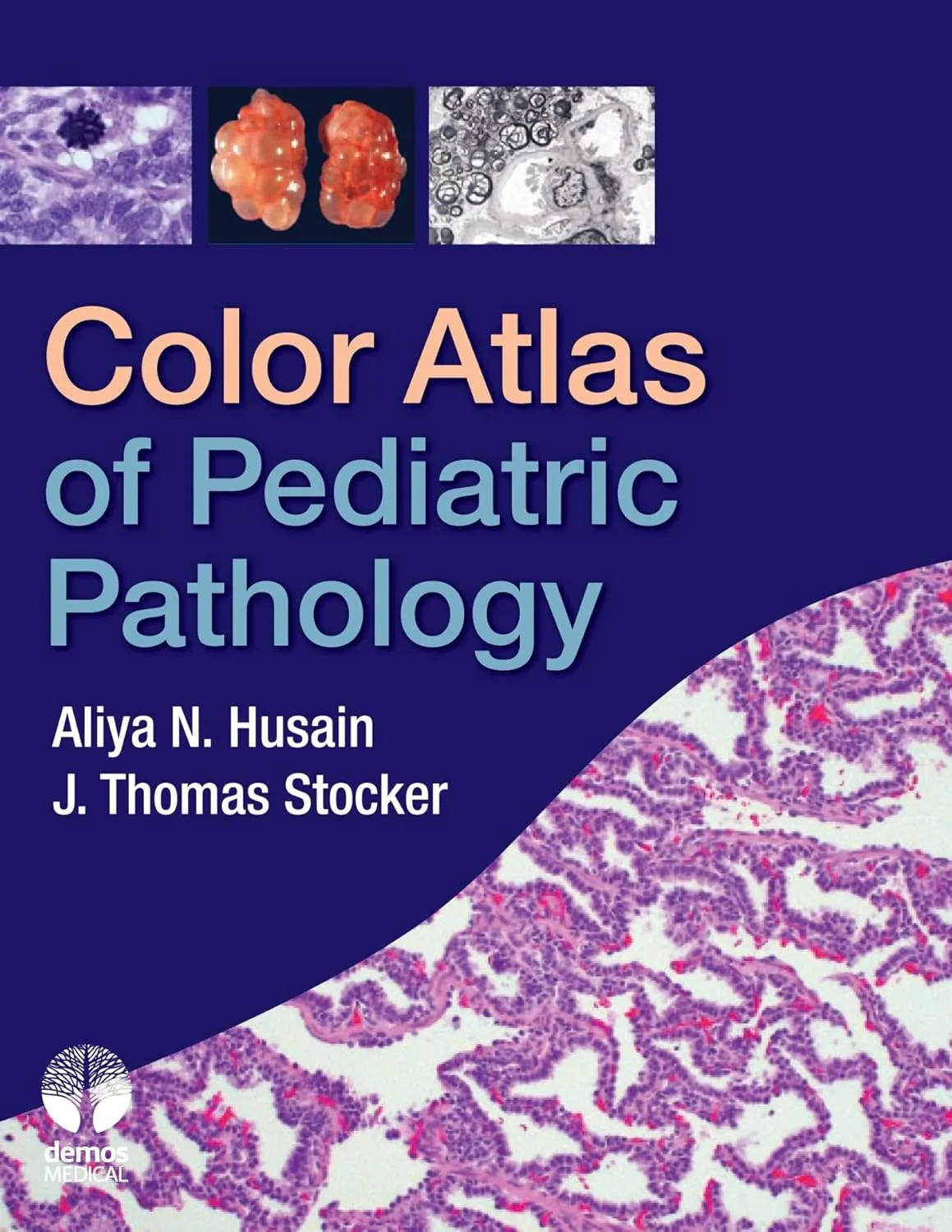 Color Atlas of Pediatric Pathology | Hardcover