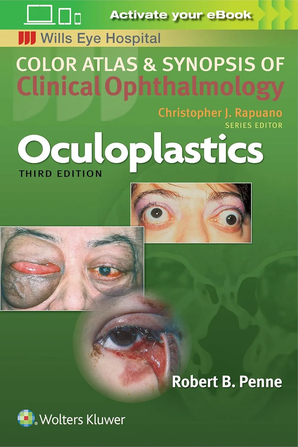 Color Atlas and Synopsis Of Clinical Ophthalmolgy Wills Eye Institute Oculoplastics Third Edition | Paperback