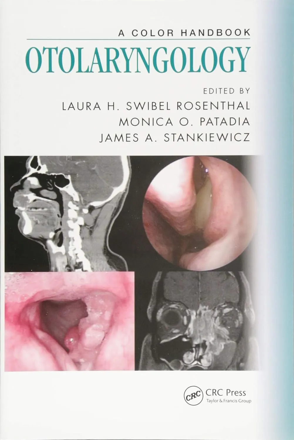 A Color Handbook Otolaryngology | Paperback