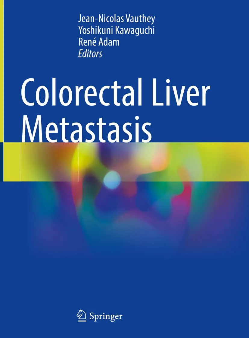 Colorectal Liver Metastasis | Hardcover