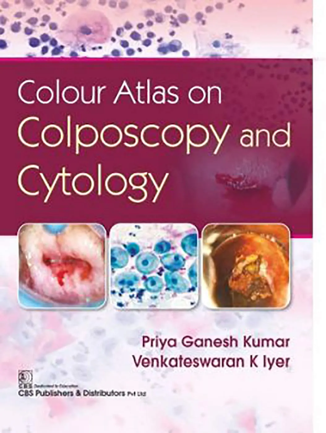 Colour Atlas on Colposcopy and Cytology | Hardcover
