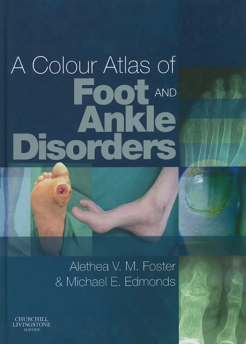 A Colour Atlas of Foot and Ankle Disorders | Hardcover