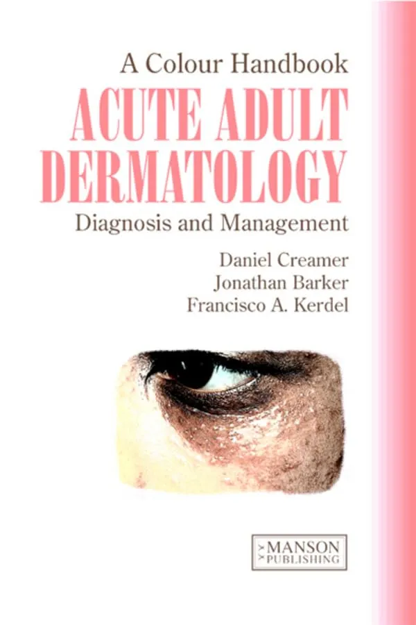 A Colour Handbook Acute Adult Dermatology | Paperback
