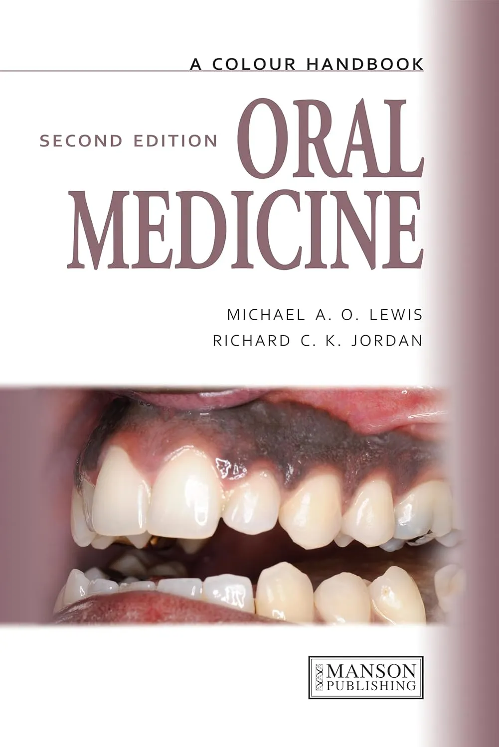 A Colour Handbook Oral Medicine | 2nd Edition | Paperback