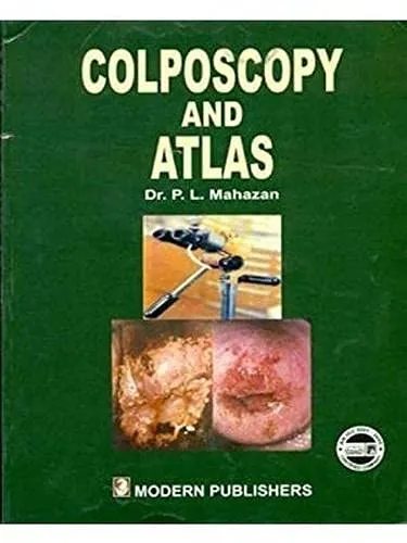 Colposcopy and Atlas | Paperback