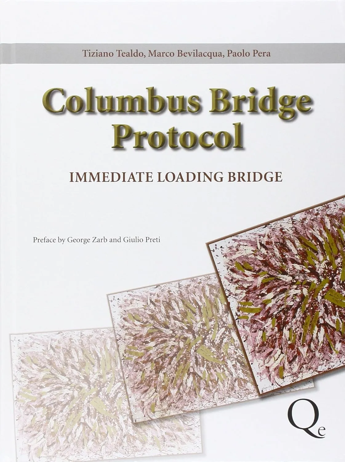 Columbus Bridge Protocol Surgical and Prosthetic Guidelines for an Immediately Loaded | Implant- Supported Prosthesis in the Edentulous Maxilla | with DVD | Hardcover
