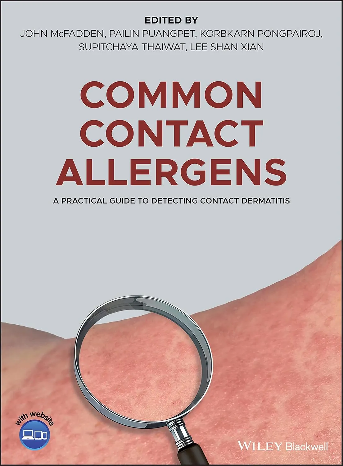 Common Contact Allergens A Practical Guide To Detecting Contact Dermatitis | Hardcover