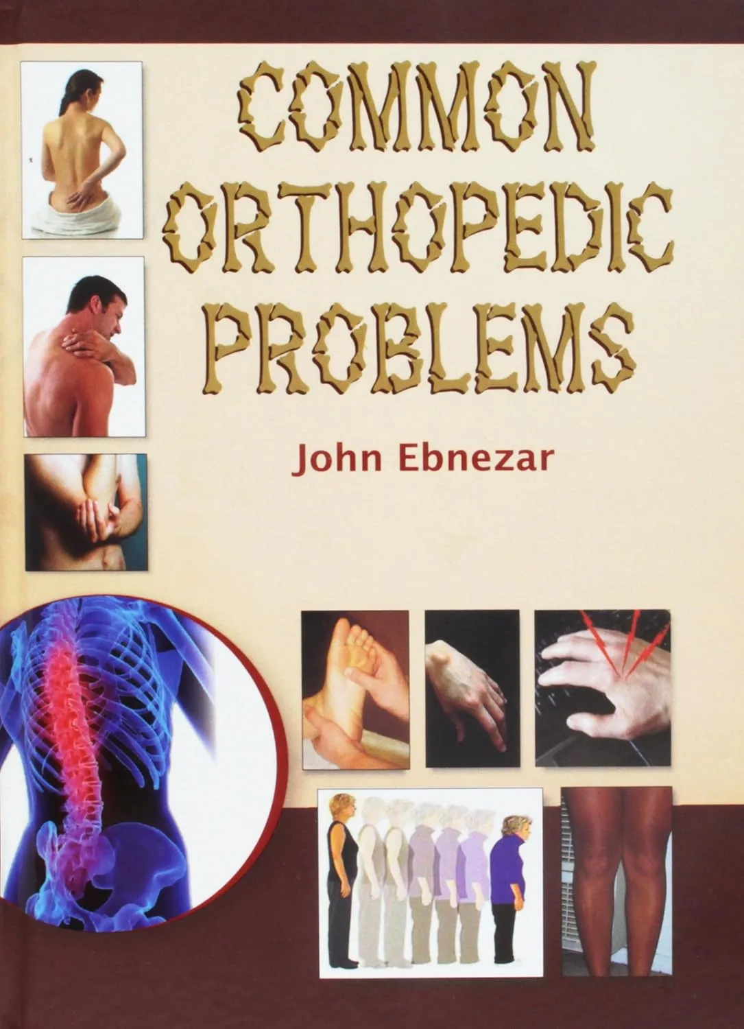 Common Orthopedic Problems | Hardcover