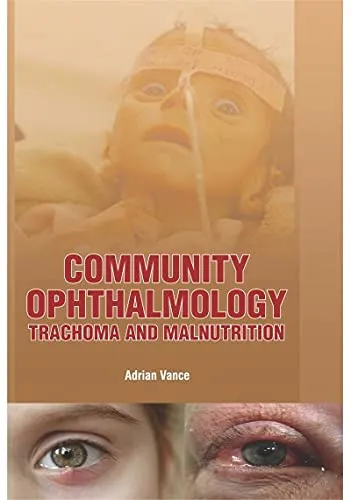 Community Ophthalmology Trachoma And Malnutrition | Hardcover