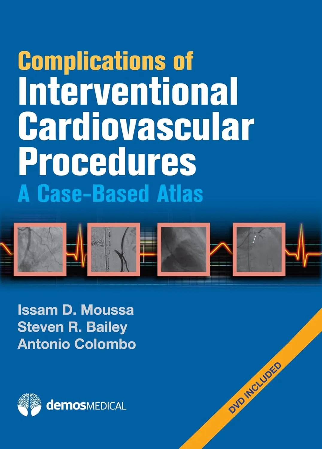 Complications of Interventional Cardiovascular Procedures A Case-Based Atlas | With DVD | Hardcover