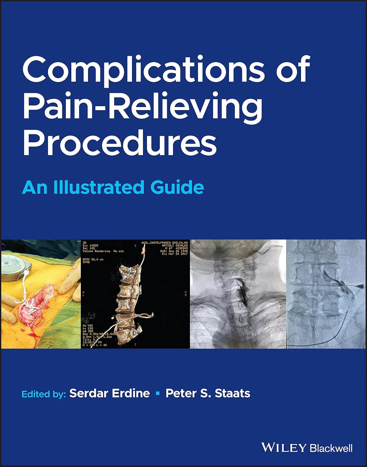 Complications Of Pain Relieving Procedures An Illustrated Guide | Hardcover