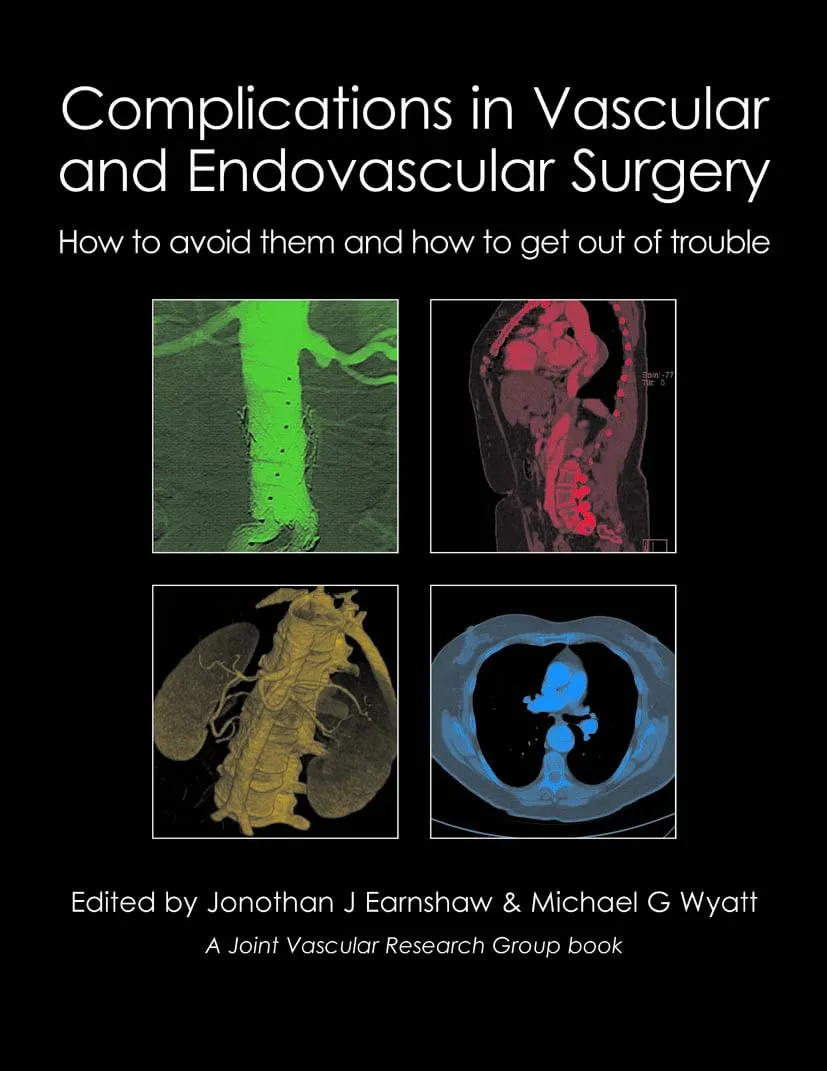 Complications in Vascular and Endovascular Surgery How to Avoid them and how to get out of Trouble | Hardcover
