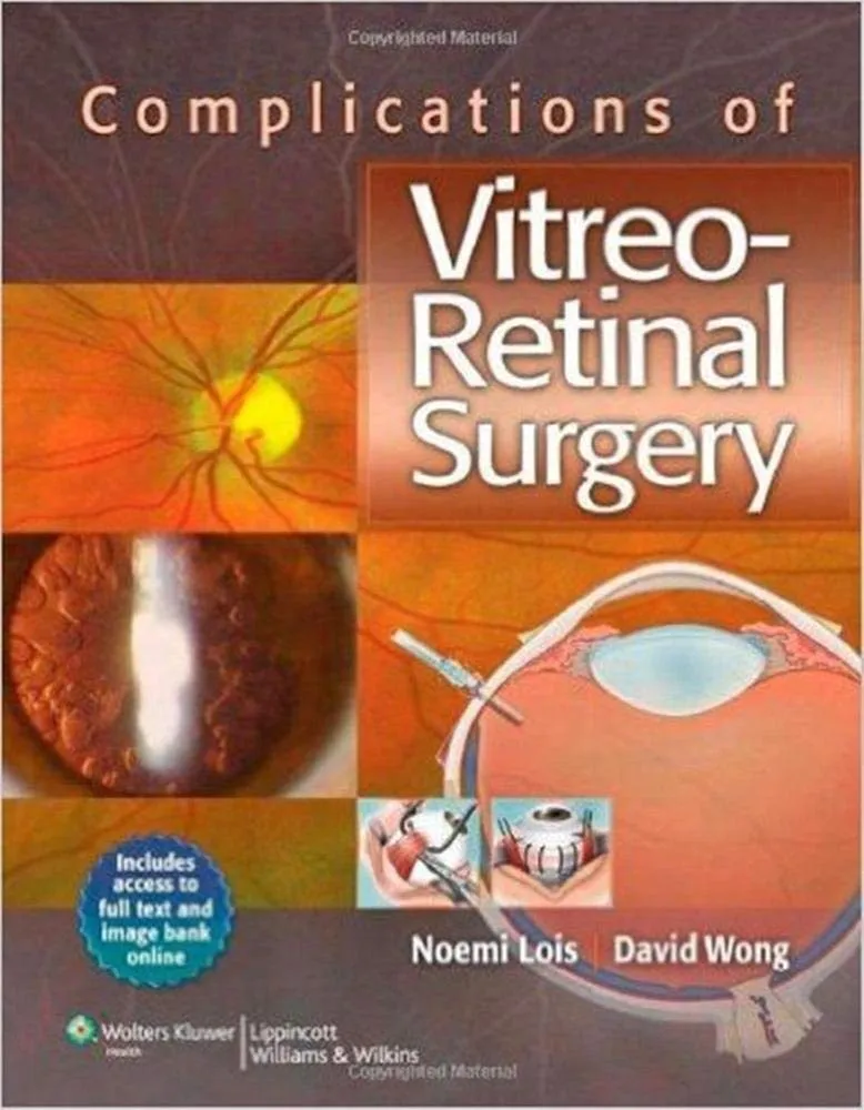 Complications of Vitreo-Retinal Surgery | Hardcover